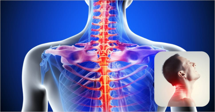 Cervical open door laminoplasty Cervical open door laminoplasty