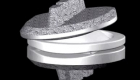 Cervical artificial disc replacement Cervical artificial disc replacement