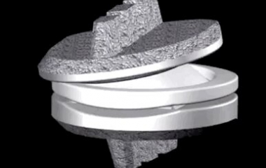 Cervical artificial disc replacement