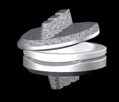 Cervical artificial disc replacement Cervical artificial disc replacement