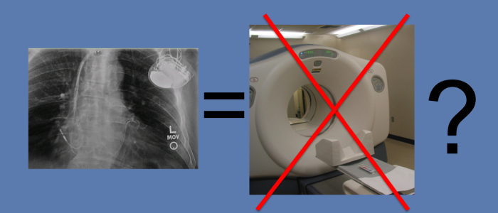 Is a Pacemaker/Defibrillator a Contraindication to MRI? Is a Pacemaker/Defibrillator a Contraindication to MRI?