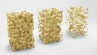 Osteoporosis and spine health Osteoporosis and spine health