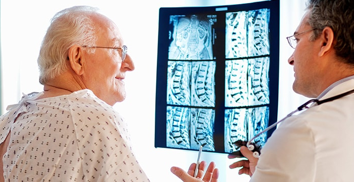 Osteoporotic vertebral fractures Osteoporotic vertebral fractures